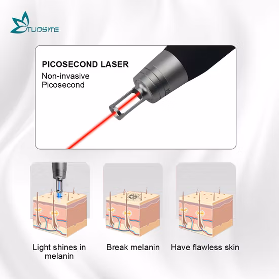 Portable Tattoo Black Doll Removal ND YAG Picosecond Laser Machine